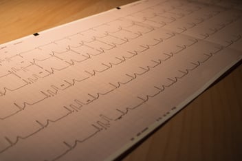 Electrocardiograma impreso