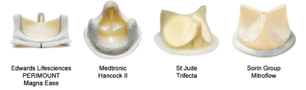 Ejemplos de prótesis biológicas cardiacas