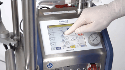 ECMO: Un Salvavidas, cuando el tiempo se agota.