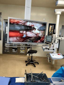 Imagen en 3D de cirugía cardiaca