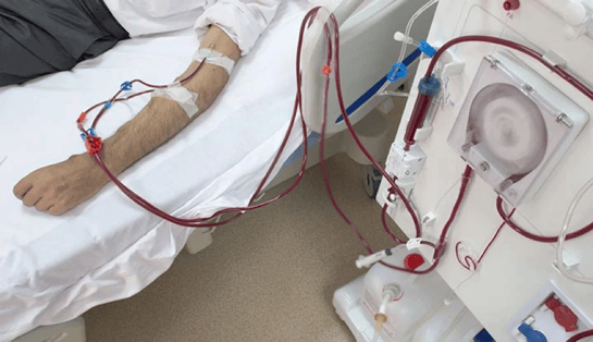 sesión de hemodiálisis en paciente con falla renal