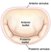 representación de la válvula mitral