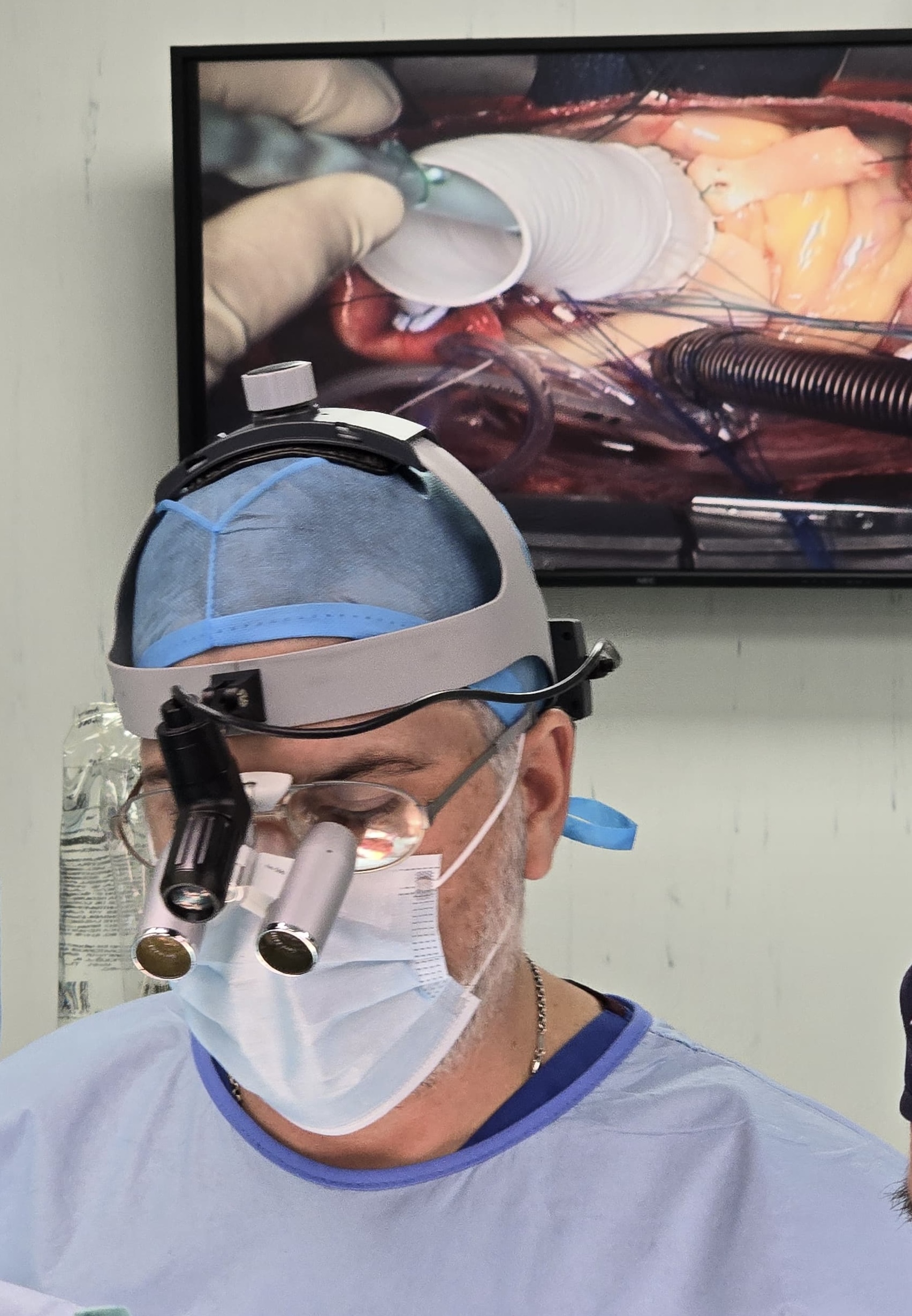 Cirujano durante un procedimiento de aorta
